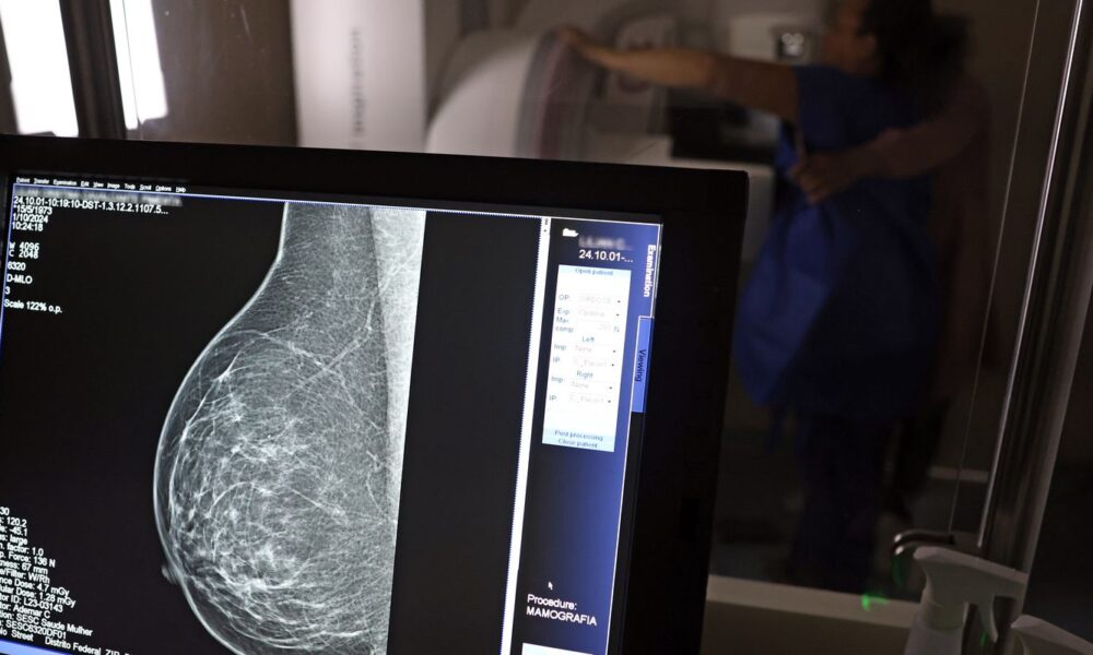 periodicidade-de-mamografias-divide-medicos-e-autoridades-de-saude