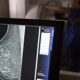 periodicidade-de-mamografias-divide-medicos-e-autoridades-de-saude