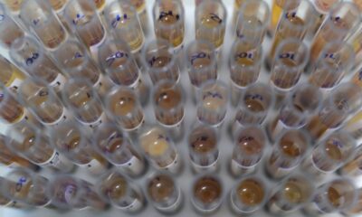 casos-de-malaria-no-brasil-caem-26%-no-primeiro-trimestre-de-2025